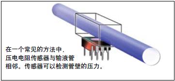 采用低功耗壓阻檢測IC設(shè)計(jì)便攜式輸液泵