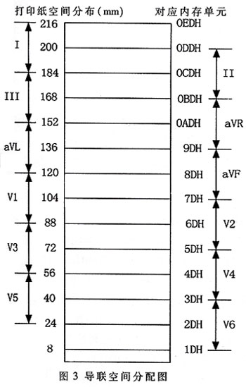 為各個(gè)導(dǎo)聯(lián)分配的熱敏打印紙空間與緩沖內(nèi)存單元